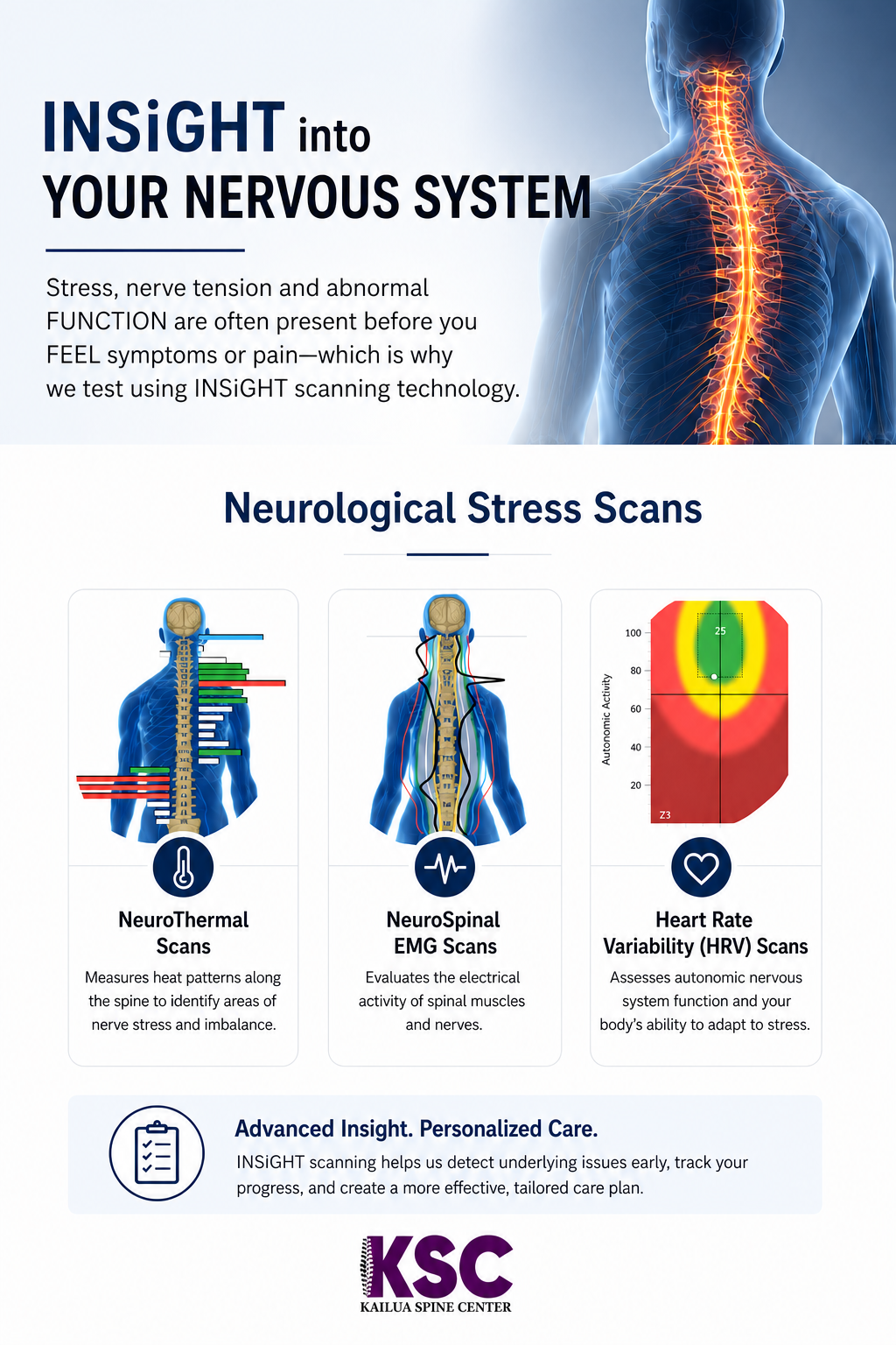 INSiGHT neurological stress scan information